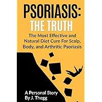 Psoriasis: The Truth: The Most Effective and Natural Diet Cure for Scalp, Body, and Arthritic Psoriasis (Psoriasis treatment psoriasis shampoo psoriasis cream psoriasis lotion) Psoriasis: The Truth: The Most Effective and Natural Diet Cure for Scalp, Body, and Arthritic Psoriasis (Psoriasis treatment psoriasis shampoo psoriasis cream psoriasis lotion) Paperback Kindle