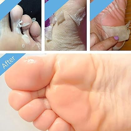 2 Pairs Foot Peel Mask Exfoliant for Soft Feet in 1-2 Weeks, Exfoliating Booties for Peeling Off Calluses & Dead Skin, For Men & Women Lavender by BEALUZ