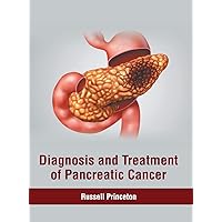 Diagnosis and Treatment of Pancreatic Cancer