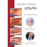 Leg Ulcer Treatment Revolution Leg Ulcer Treatment Revolution Paperback Kindle