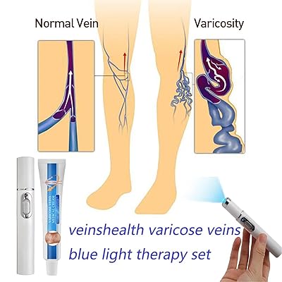 Spider Vein Treatment for Legs, Venoheal Varicose Vein Treatment Cream,  Vericose Veins Treatment Blue Light Lazer Treatment Pen, Blue Light Pen for