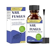 Toenail Fungus Treatment Extra Strength: Nail Repair Solution for Toenail or Fingernail - Strong Renewal Liquid for Discolored or Damaged Nail - 30 ML (1 FL OZ)