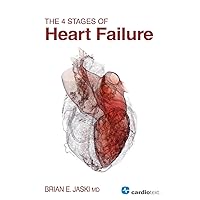 4 Stages of Heart Failure 4 Stages of Heart Failure Paperback Kindle Mass Market Paperback