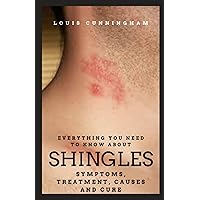 EVERYTHING YOU NEED TO KNOW ABOUT SHINGLES: SYMPTOMS, TREATMENT , CAUSES AND CURE EVERYTHING YOU NEED TO KNOW ABOUT SHINGLES: SYMPTOMS, TREATMENT , CAUSES AND CURE Paperback Kindle