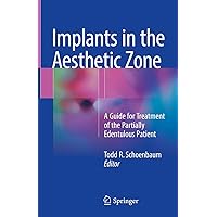 Implants in the Aesthetic Zone: A Guide for Treatment of the Partially Edentulous Patient Implants in the Aesthetic Zone: A Guide for Treatment of the Partially Edentulous Patient Hardcover Kindle