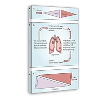 TSFTEC Smoking Addiction Lung Cancer Poster Poster for Lung Health Guidelines (2) Canvas Painting Posters And Prints Wall Art Pictures for Living Room Bedroom Decor 08x12inch(20x30cm) Frame-style