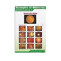 Examples of Different Ophthalmology Posters Eye Hospital Poster Canvas Painting Posters And Prints Wall Art Pictures for Living Room Bedroom Decor 24x36inch(60x90cm) Unframe-style