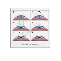 Hospital Ophthalmology Wall Posters Myopia Laser Surgery Animation Process Poster Canvas Painting Wall Art Poster for Bedroom Living Room Decor 20x20inch(50x50cm) Unframe-style