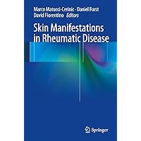 Skin Manifestations in Rheumatic Disease Skin Manifestations in Rheumatic Disease Kindle Paperback