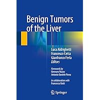 Benign Tumors of the Liver Benign Tumors of the Liver Kindle Hardcover Paperback