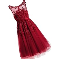 Women Short Evening Dress Prom Dress Lace With Pearls Cocktail Party Gowns