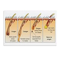 Hair Loss Poster Beauty Salon Treatment Poster Hair Growth Stages Chart Poster 3 Canvas Wall Art Poster Print Picture Paintings for Living Room Bedroom Office Decoration, Canvas Poster Art Gift for Fa