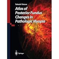 Atlas of Posterior Fundus Changes in Pathologic Myopia Atlas of Posterior Fundus Changes in Pathologic Myopia Kindle Hardcover Paperback