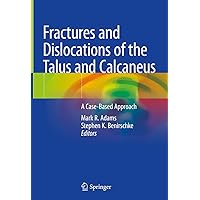 Fractures and Dislocations of the Talus and Calcaneus: A Case-Based Approach Fractures and Dislocations of the Talus and Calcaneus: A Case-Based Approach Kindle Hardcover Paperback