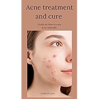 Acne treatment and cure: Guide on How to cure acne naturally Acne treatment and cure: Guide on How to cure acne naturally Kindle Paperback