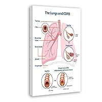 Smoking Addiction Lung Cancer Poster Poster for Lung Cancer Histological Guidelines(1) Canvas Painting Posters And Prints Wall Art Pictures for Living Room Bedroom Decor 08x12inch(20x30cm) Frame-styl