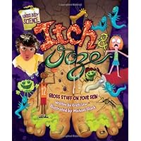 Itch & Ooze: Gross Stuff on Your Skin (Gross Body Science) Itch & Ooze: Gross Stuff on Your Skin (Gross Body Science) Library Binding