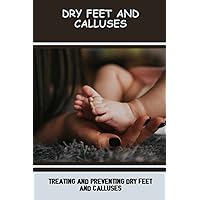 Dry Feet And Calluses: Treating And Preventing Dry Feet And Calluses