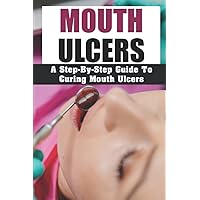Mouth Ulcers: A Step-By-Step Guide To Curing Mouth Ulcers