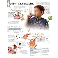 Understanding Asthma chart: Laminated Wall Chart