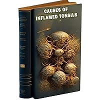 Causes of Inflamed Tonsils: Explore the reasons for inflamed tonsils and methods for relieving discomfort. Causes of Inflamed Tonsils: Explore the reasons for inflamed tonsils and methods for relieving discomfort. Paperback
