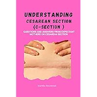 Understanding Cesarean Section (C-section): Questions and Answers from Expectant Mothers on C- Section (Birth Methods) Understanding Cesarean Section (C-section): Questions and Answers from Expectant Mothers on C- Section (Birth Methods) Kindle Paperback