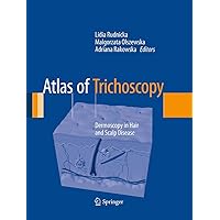 Atlas of Trichoscopy: Dermoscopy in Hair and Scalp Disease Atlas of Trichoscopy: Dermoscopy in Hair and Scalp Disease Paperback Kindle Hardcover