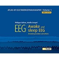 Atlas of Electroencephalography. Awake and sleep EEG. Activation procedures and artifacts Atlas of Electroencephalography. Awake and sleep EEG. Activation procedures and artifacts Hardcover Kindle