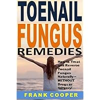 Toenail Fungus Remedies: How to Treat and Reverse Toenail Fungus Naturally -- WITHOUT Drugs or Surgery!
