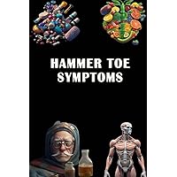 Hammer Toe Symptoms: Recognize Hammer Toe Symptoms - Address Foot Deformity and Explore Treatment Options!