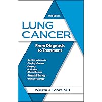 Lung Cancer: From Diagnosis to Treatment Lung Cancer: From Diagnosis to Treatment Paperback Kindle