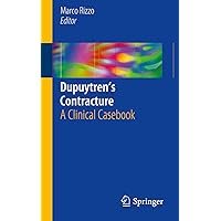 Dupuytren’s Contracture: A Clinical Casebook Dupuytren’s Contracture: A Clinical Casebook Kindle Paperback