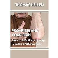 Psoarisis And Your Skin: How to Effectively Manage Psoriasis And Symptoms