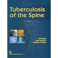 Tuberculosis of the Spine Tuberculosis of the Spine Hardcover Paperback
