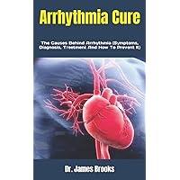 Arrhythmia Cure: The Causes Behind Arrhythmia (Symptoms, Diagnosis, Treetment And How To Prevent It)
