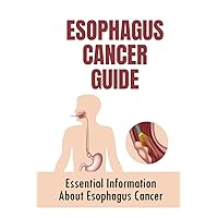 Esophagus Cancer Guide: Essential Information About Esophagus Cancer