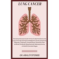 LUNG CANCER: The Comprehensive Guide On How To Beat And Overcome Lung Cancer By Gaining Knowledge On; Causes, Symptoms, Diagnosis, Treatment, ... Adenocarcinoma, Limited Or Extensive Stages