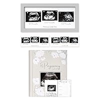 KeaBabies Sonogram Picture Frame and Pregnancy Journal, Pregnancy Announcements - Trio Ultrasound Picture Frames For Mom To Be Gift - 80 Pages Hard Cover Pregnancy Book For Mom To Be Gift