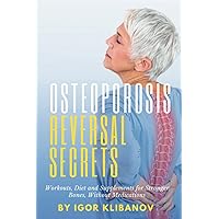 Osteoporosis Reversal Secrets: Workouts, Diet and Supplements for Stronger Bones Without Medications Osteoporosis Reversal Secrets: Workouts, Diet and Supplements for Stronger Bones Without Medications Paperback Kindle