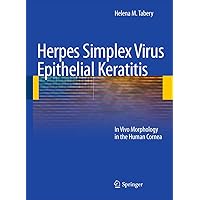 Herpes Simplex Virus Epithelial Keratitis: In Vivo Morphology in the Human Cornea Herpes Simplex Virus Epithelial Keratitis: In Vivo Morphology in the Human Cornea Kindle Paperback
