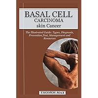 BASAL CELL CARCINOMA SKIN CANCER: The Illustrated Guide: Types, Diagnosis, Prevention, Test, Management, Resources And Questions to ask your doctors.