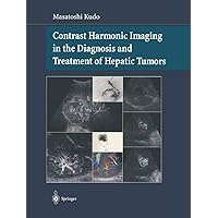 Contrast Harmonic Imaging in the Diagnosis and Treatment of Hepatic Tumors Contrast Harmonic Imaging in the Diagnosis and Treatment of Hepatic Tumors Paperback Kindle Hardcover