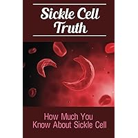 Sickle Cell Truth: How Much You Know About Sickle Cell
