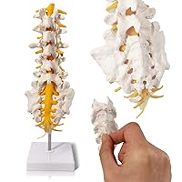 Evotech Lumbar Spine Anatomy Model with Sacrum and Spinal Nerves, Didactic Replica of Lumbrosacral Section with Nerves and A Herniated Disc at L4, Includes Base for Medical Teaching Display