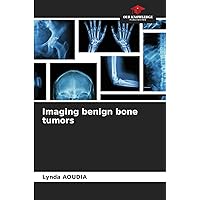Imaging benign bone tumors