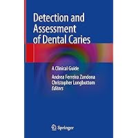 Detection and Assessment of Dental Caries: A Clinical Guide Detection and Assessment of Dental Caries: A Clinical Guide Kindle Hardcover