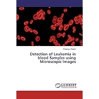 Detection of Leukemia in blood Samples using Microscopic Images