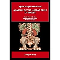 ANATOMY OF THE LUMBAR SPINE CT IMAGES: Spine images collection ANATOMY OF THE LUMBAR SPINE CT IMAGES: Spine images collection Kindle Paperback