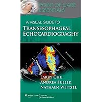 A Visual Guide to Transesophageal Echocardiography (Point of Care Essentials) A Visual Guide to Transesophageal Echocardiography (Point of Care Essentials) Spiral-bound Kindle