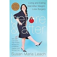 Before & After, Revised Edition: Living and Eating Well After Weight-Loss Surgery Before & After, Revised Edition: Living and Eating Well After Weight-Loss Surgery Paperback